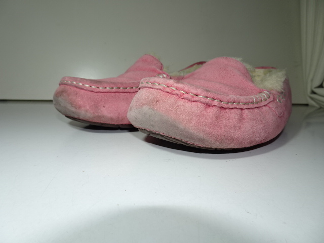 つま先周辺の汚れ