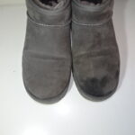 左足つま先に濃いシミ