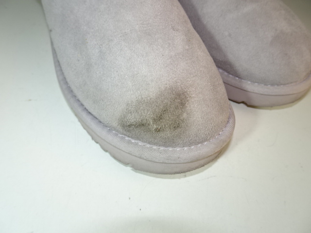 右足つま先のシミ